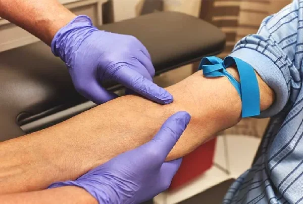 Blood Test With Home Visit