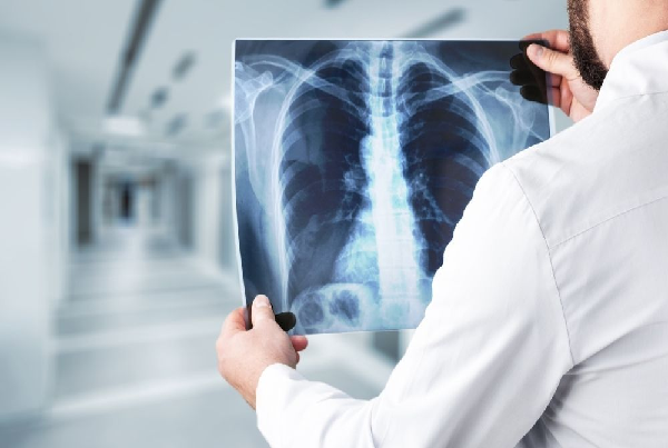 Digital X-Ray