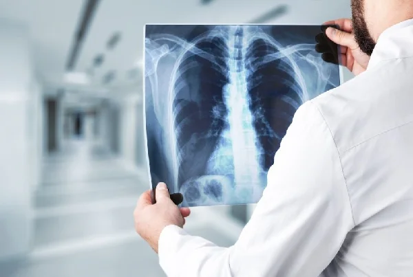 Digital X-Ray