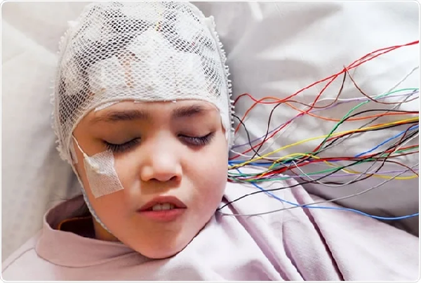 EEG On Appointment Basis